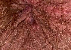  Extreme Close Up Big Clit Vagina Asshole Mouth Giantess Fetish Video Hairy Body 